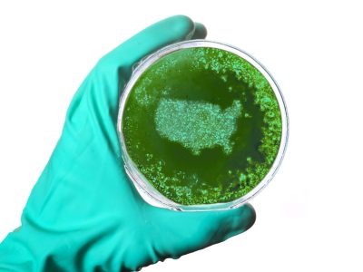 Petri dish with germs shaped as USA.(series) A scientist holding a petri dish with germs in the shape of USA.(series)